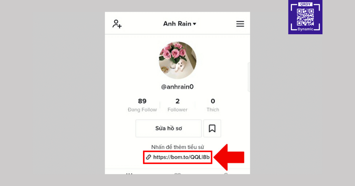 Tiktok Bio Link